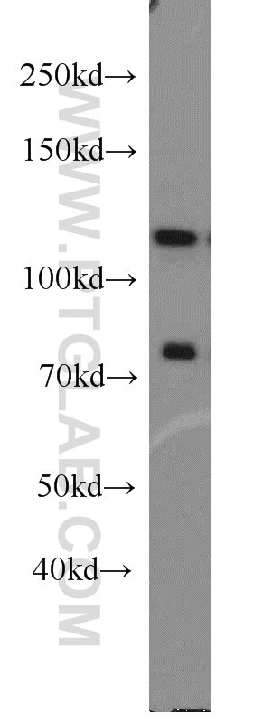 Western Blot (WB) analysis of Jurkat cells using DGCR8 C-terminal Polyclonal antibody (10996-1-AP)