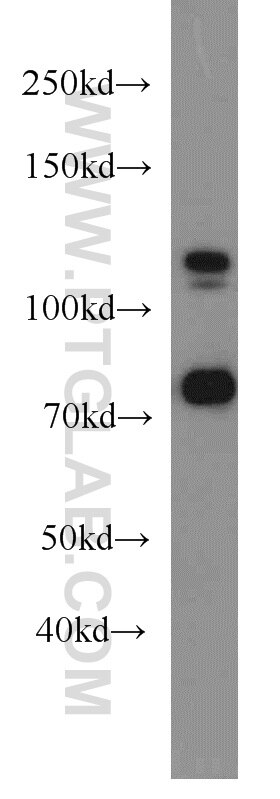 Western Blot (WB) analysis of HeLa cells using DGCR8 C-terminal Polyclonal antibody (10996-1-AP)