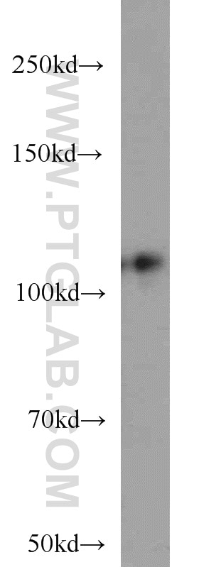 Western Blot (WB) analysis of Jurkat cells using DGCR8 C-terminal Polyclonal antibody (10996-1-AP)