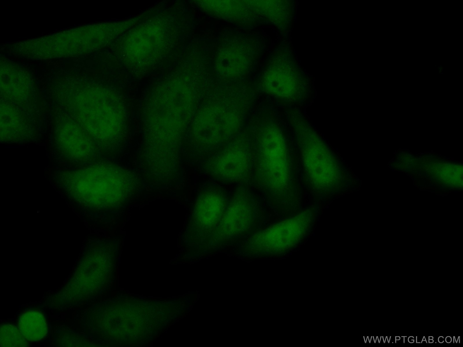 Immunofluorescence (IF) / fluorescent staining of HeLa cells using DGCR8 N-terminal Polyclonal antibody (25835-1-AP)