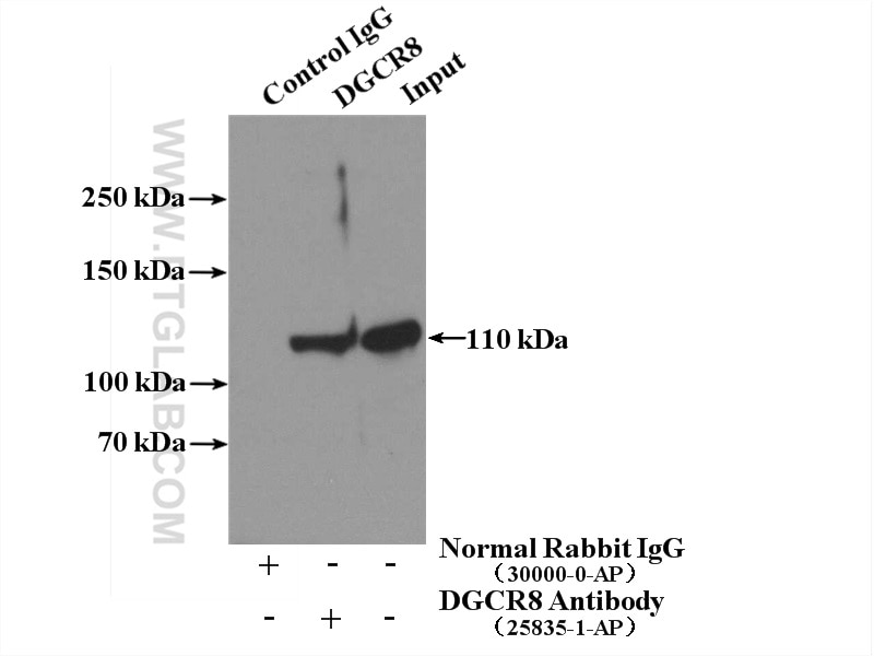 Immunoprecipitation (IP) experiment of A431 cells using DGCR8 N-terminal Polyclonal antibody (25835-1-AP)