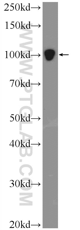 WB analysis of HeLa using 25835-1-AP