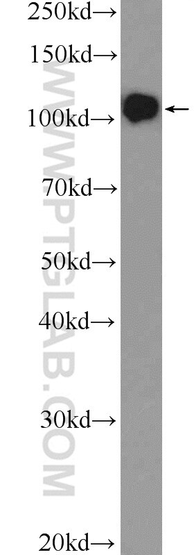 Western Blot (WB) analysis of Jurkat cells using DGCR8 N-terminal Polyclonal antibody (25835-1-AP)