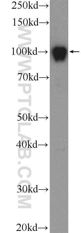 WB analysis of HepG2 using 25835-1-AP