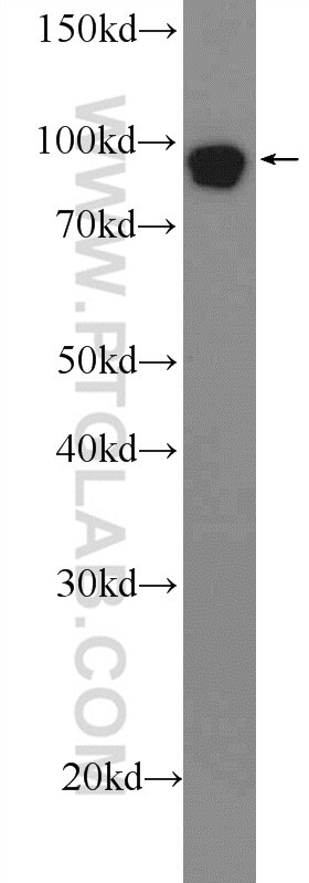 Western Blot (WB) analysis of A431 cells using DGCR8 N-terminal Polyclonal antibody (25835-1-AP)