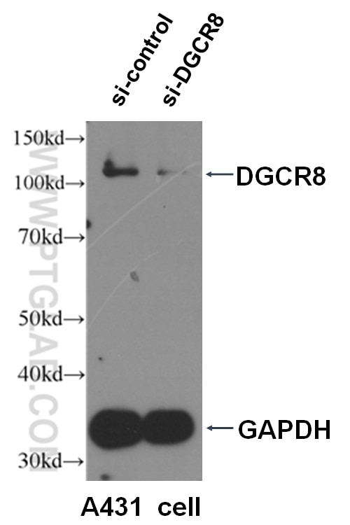 Western Blot (WB) analysis of A431 cells using DGCR8 N-terminal Polyclonal antibody (25835-1-AP)