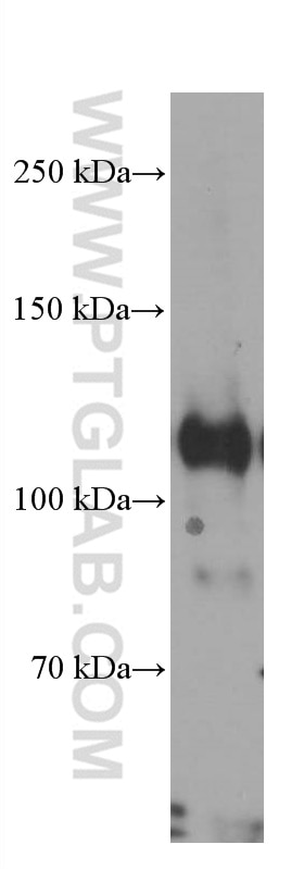 WB analysis of RAW 264.7 using 60084-1-Ig