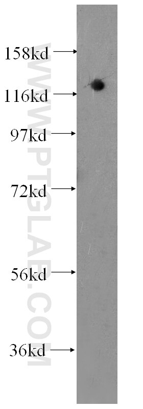 Western Blot (WB) analysis of HepG2 cells using DGCR8 Monoclonal antibody (60084-1-Ig)