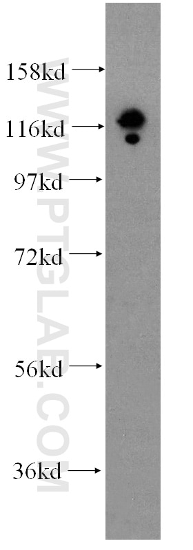 Western Blot (WB) analysis of BxPC-3 cells using DGCR8 Monoclonal antibody (60084-1-Ig)