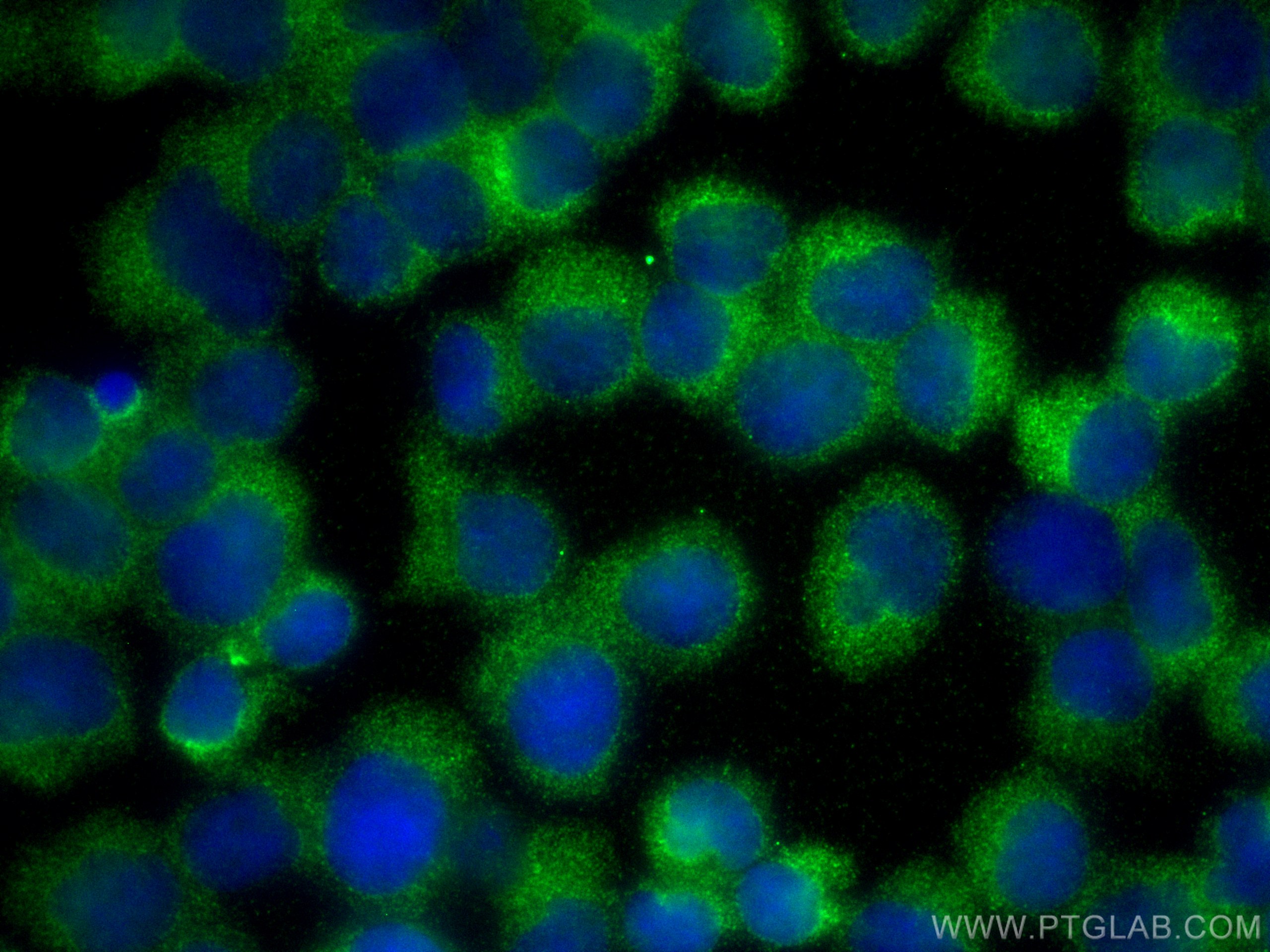 Immunofluorescence (IF) / fluorescent staining of Jurkat cells using DGKA Polyclonal antibody (11547-1-AP)