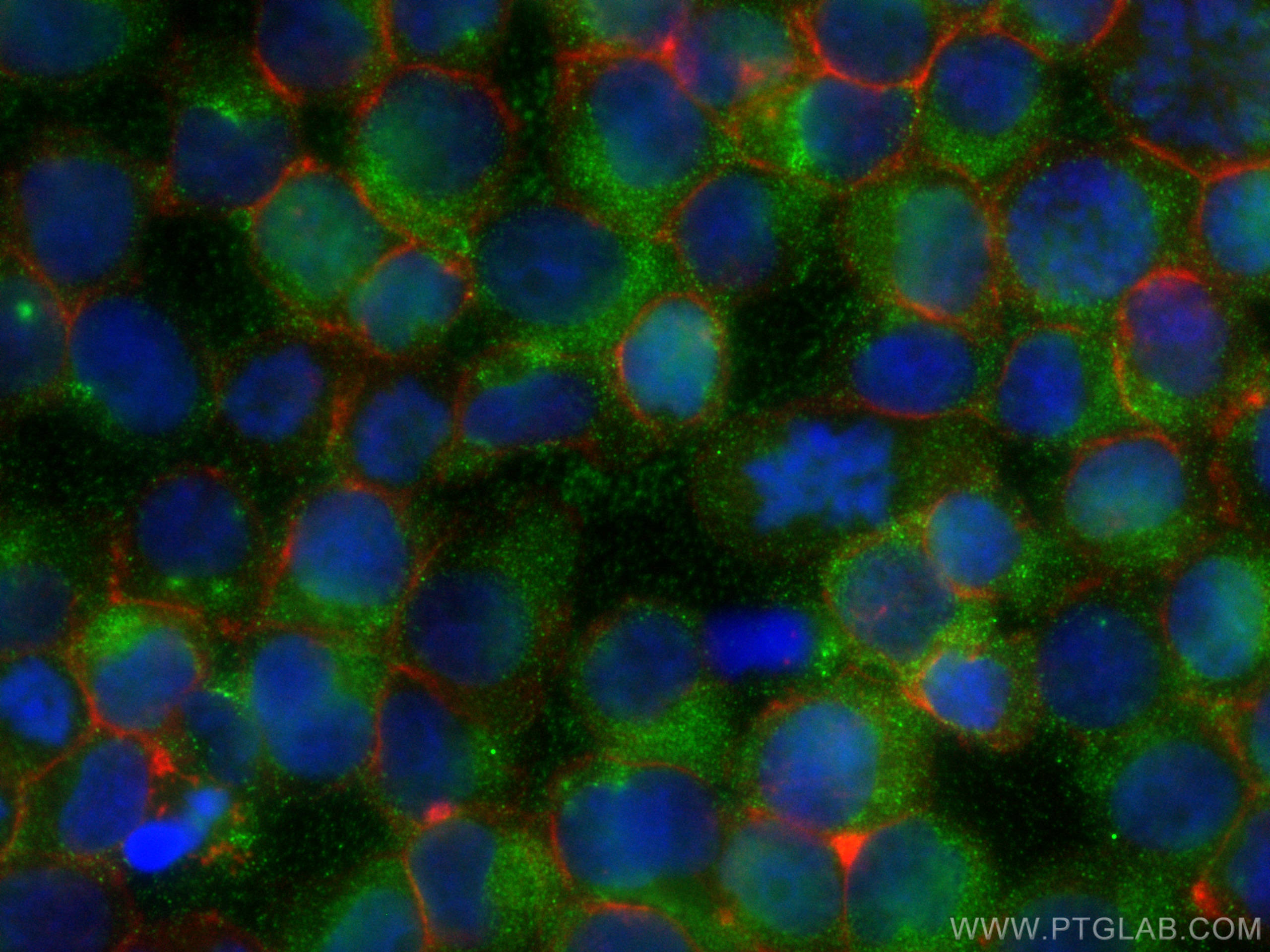 IF Staining of Jurkat using 11547-1-AP