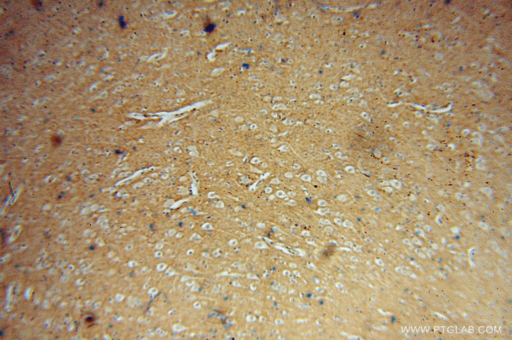 Immunohistochemistry (IHC) staining of human brain tissue using DGKA Polyclonal antibody (11547-1-AP)