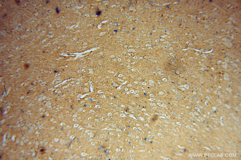 IHC staining of human brain using 11547-1-AP