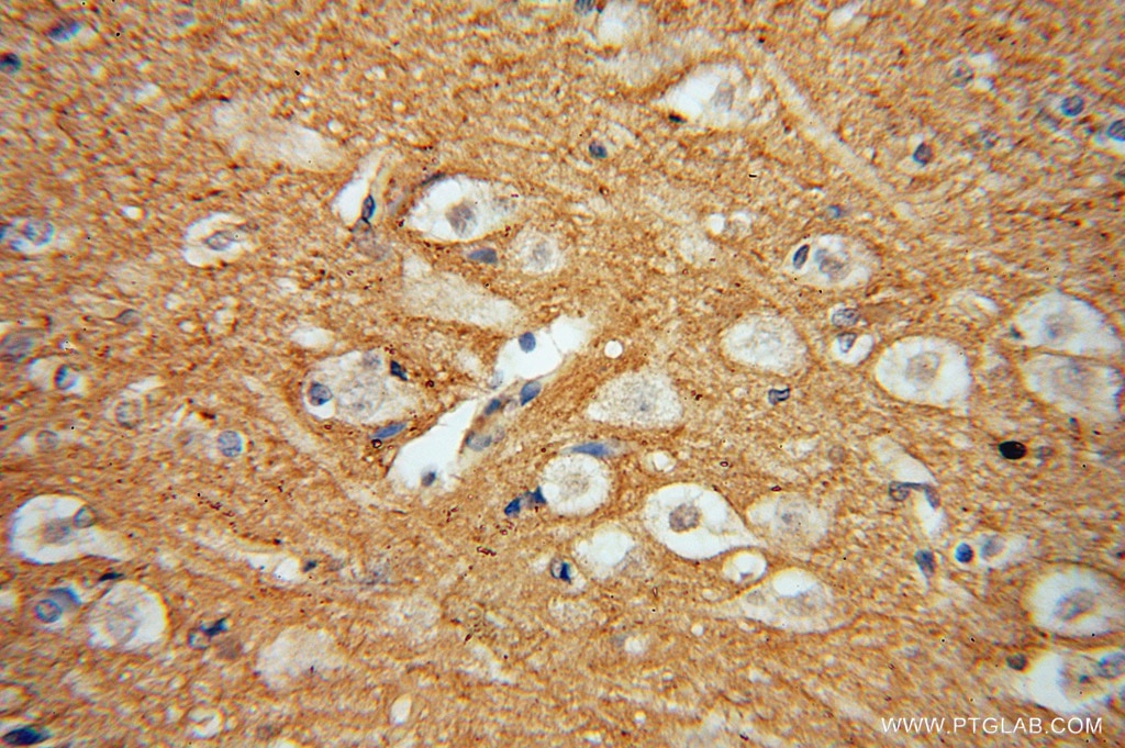 Immunohistochemistry (IHC) staining of human brain tissue using DGKA Polyclonal antibody (11547-1-AP)