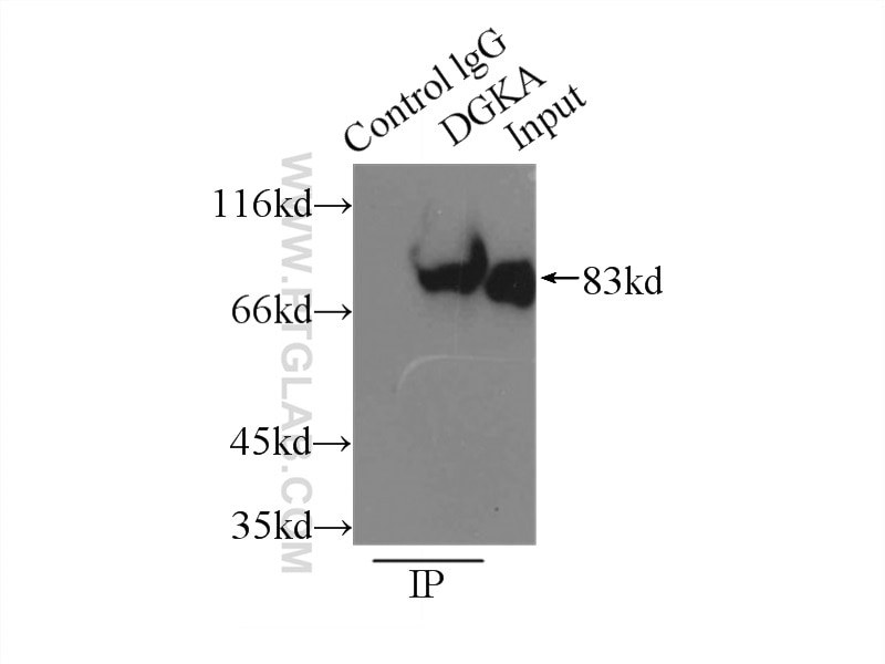 Immunoprecipitation (IP) experiment of Jurkat cells using DGKA Polyclonal antibody (11547-1-AP)