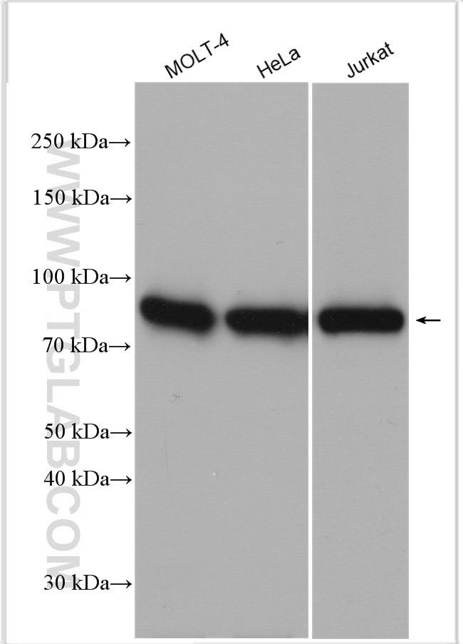 Western Blot (WB) analysis of various lysates using DGKA Polyclonal antibody (11547-1-AP)