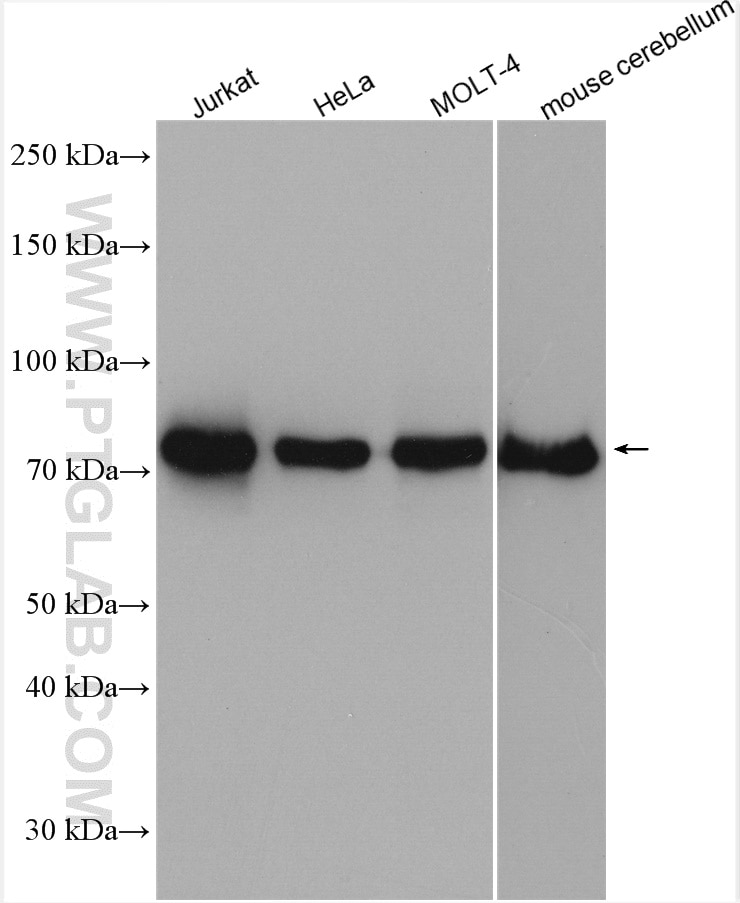 Western Blot (WB) analysis of various lysates using DGKA Polyclonal antibody (11547-1-AP)