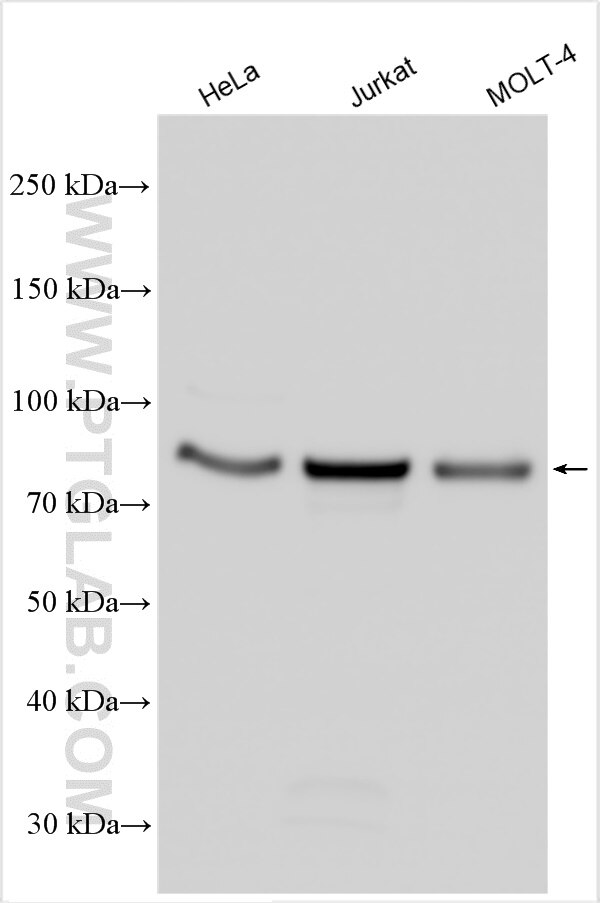 Western Blot (WB) analysis of various lysates using DGKA Polyclonal antibody (11547-1-AP)