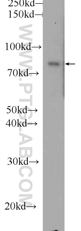 Western Blot (WB) analysis of HEK-293 cells using DGKA Polyclonal antibody (11547-1-AP)