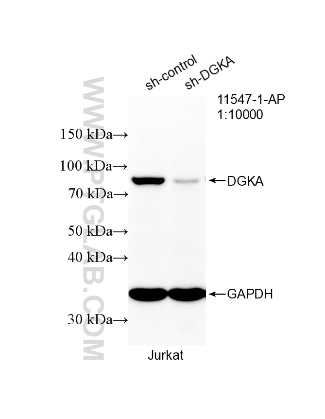 WB analysis of Jurkat using 11547-1-AP Western Blot (WB) analysis of Jurkat cells using DGKA Polyclonal antibody (11547-1-AP)