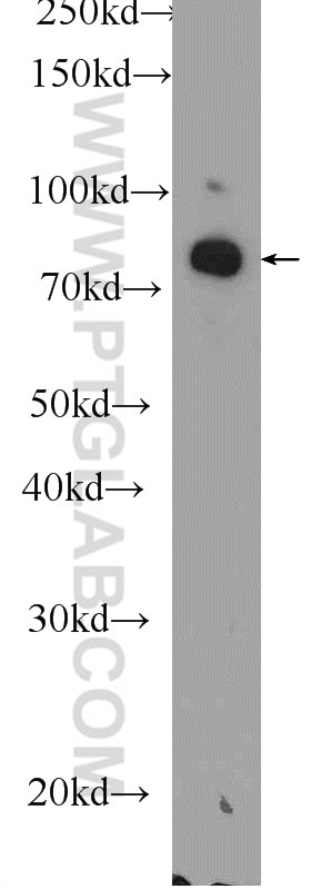 WB analysis of mouse cerebellum using 11547-1-AP