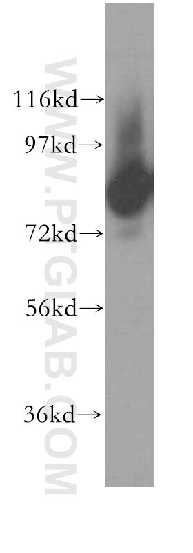 Western Blot (WB) analysis of human cerebellum tissue using DGKA Polyclonal antibody (11547-1-AP)