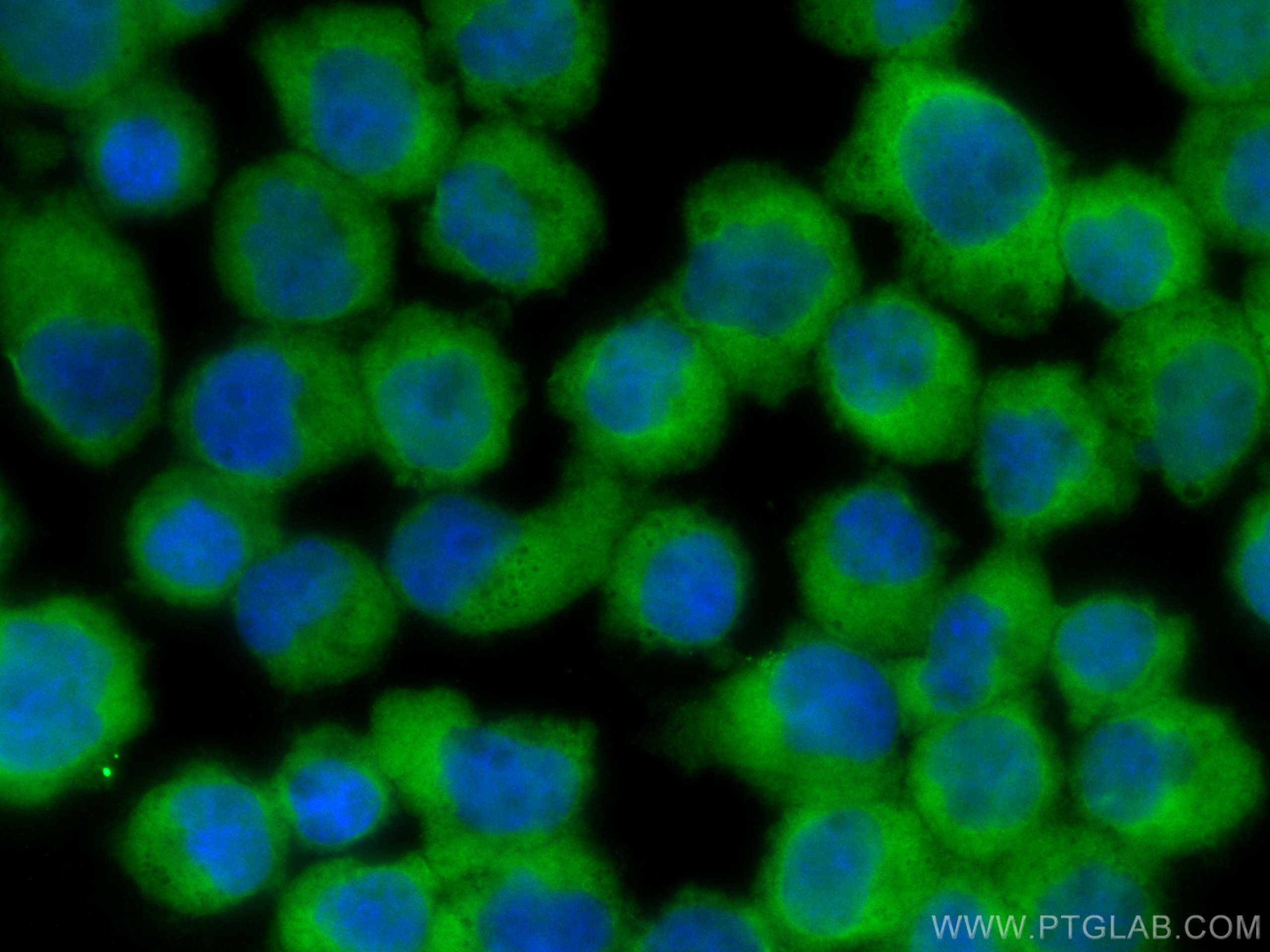 Immunofluorescence (IF) / fluorescent staining of Jurkat cells using CoraLite® Plus 488-conjugated DGKA Polyclonal anti (CL488-11547)