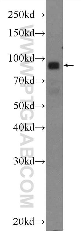Western Blot (WB) analysis of HeLa cells using DGKB Polyclonal antibody (24320-1-AP)