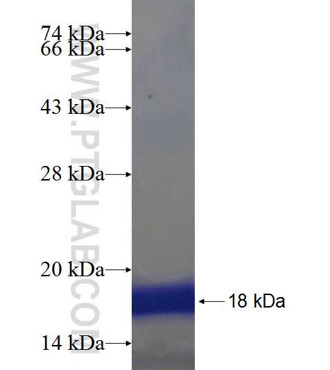 DGKB fusion protein Ag19809 SDS-PAGE