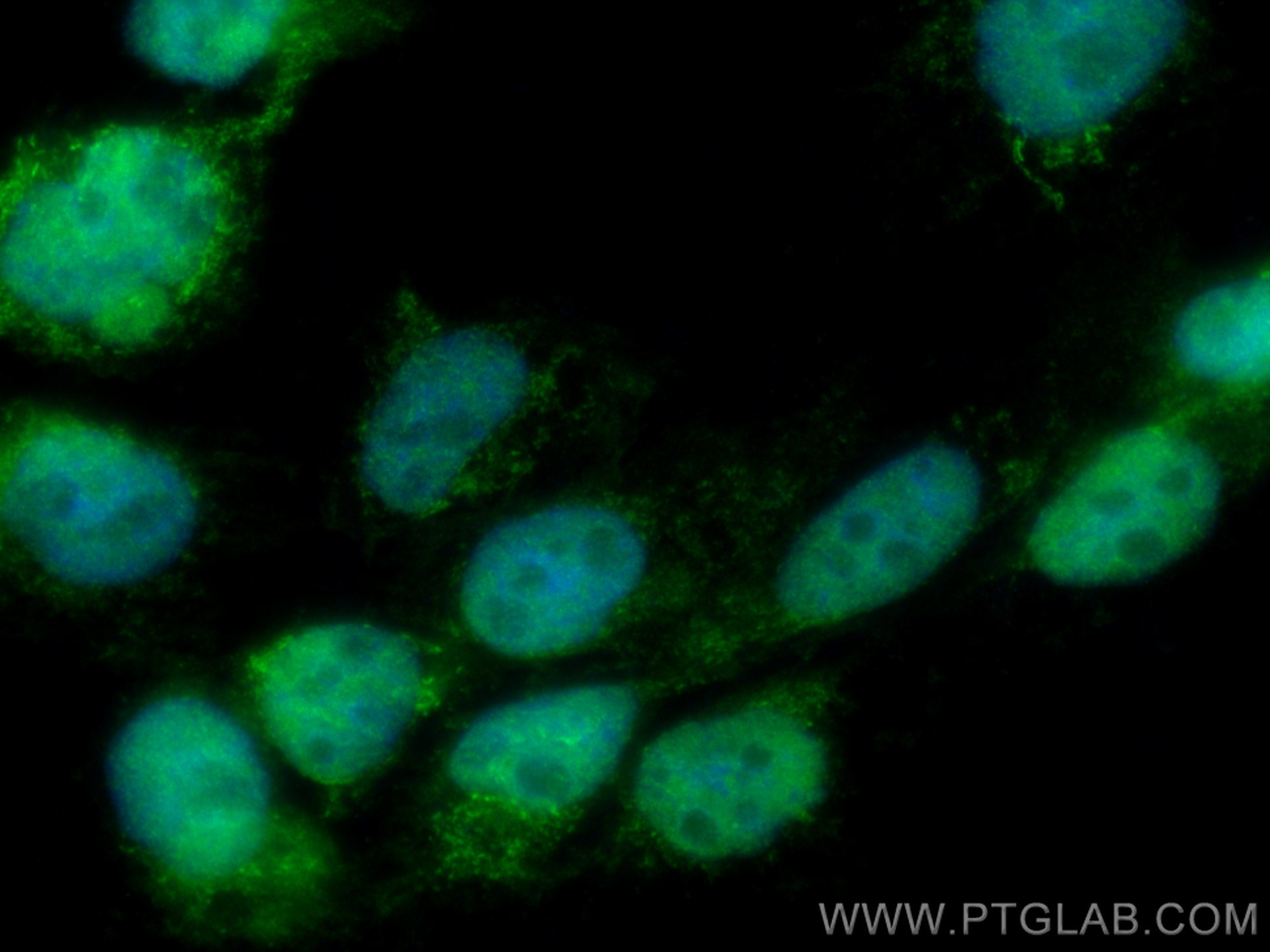 Immunofluorescence (IF) / fluorescent staining of A431 cells using DGKE Polyclonal antibody (11900-1-AP)