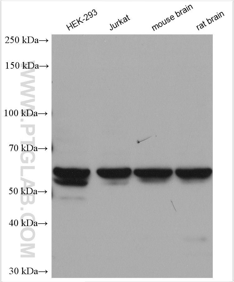 Western Blot (WB) analysis of various lysates using DGKE Polyclonal antibody (11900-1-AP)