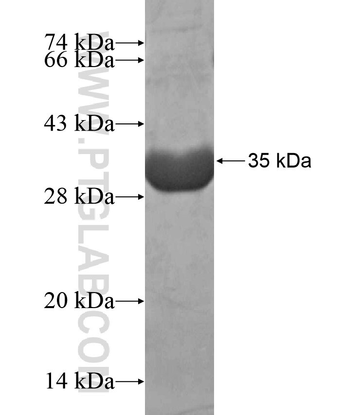 DGKG fusion protein Ag17410 SDS-PAGE