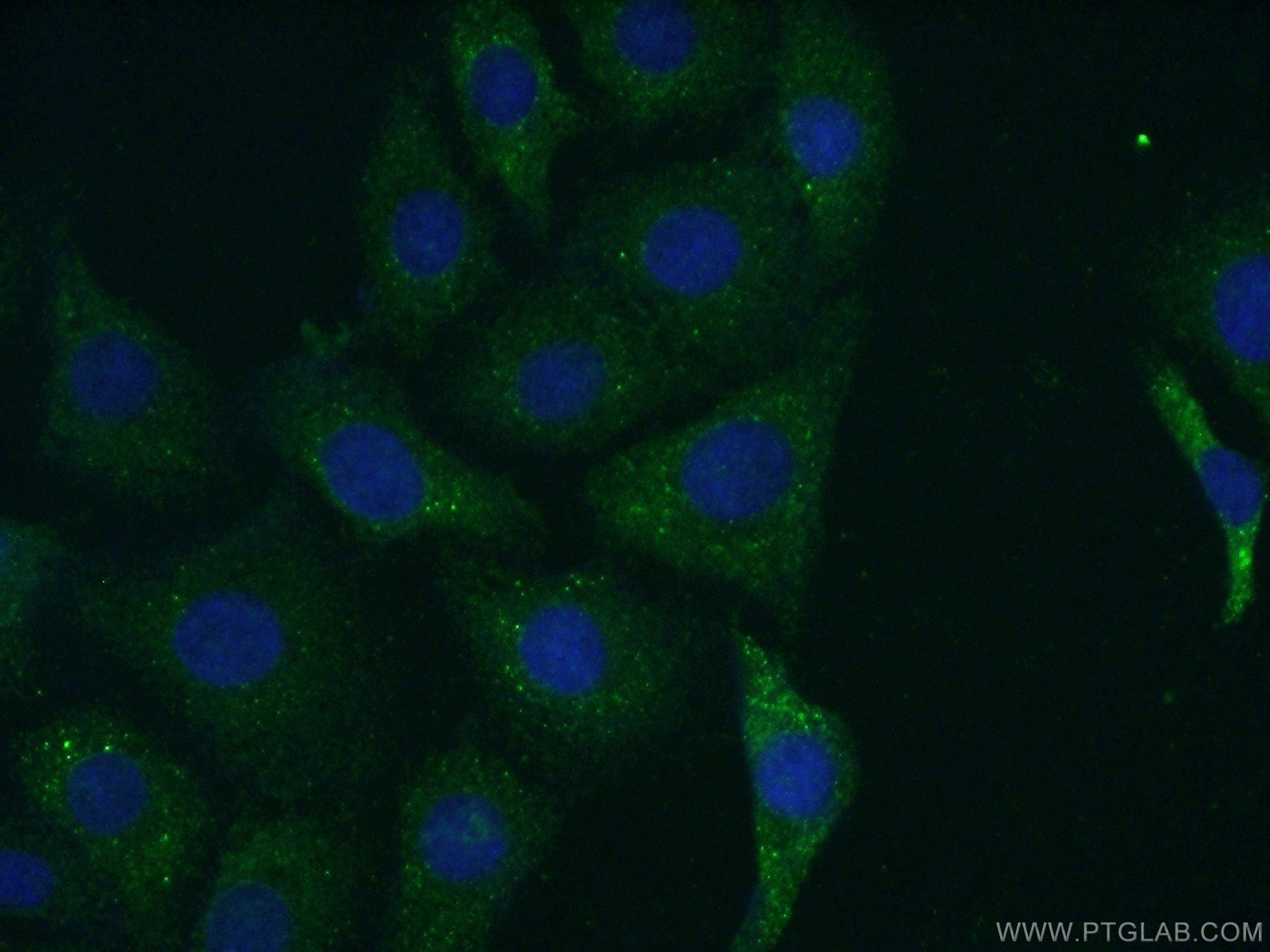 IF Staining of SH-SY5Y using 13873-1-AP