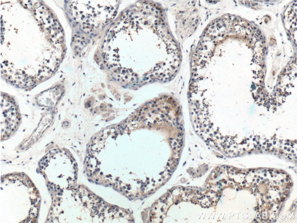 Immunohistochemistry (IHC) staining of human testis tissue using DGKH Polyclonal antibody (13873-1-AP)