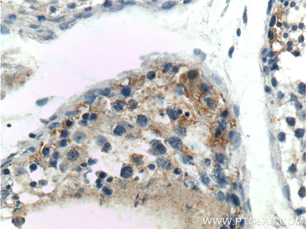 Immunohistochemistry (IHC) staining of human testis tissue using DGKH Polyclonal antibody (13873-1-AP)