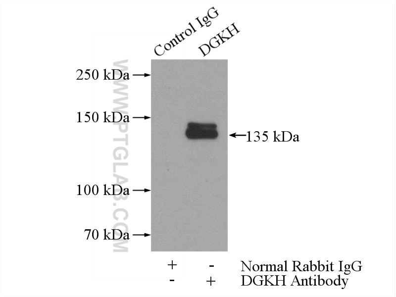 Immunoprecipitation (IP) experiment of mouse brain tissue using DGKH Polyclonal antibody (13873-1-AP)