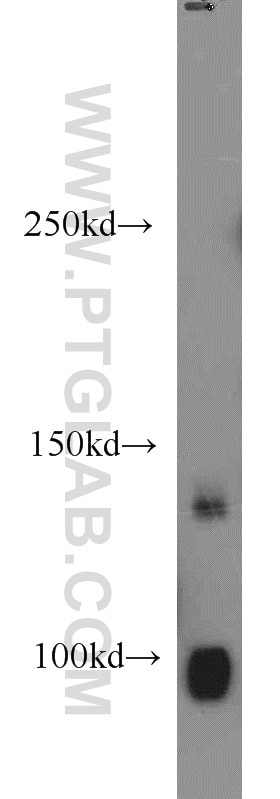 Western Blot (WB) analysis of mouse brain tissue using DGKH Polyclonal antibody (13873-1-AP)