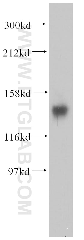Western Blot (WB) analysis of mouse brain tissue using DGKH Polyclonal antibody (13873-1-AP)