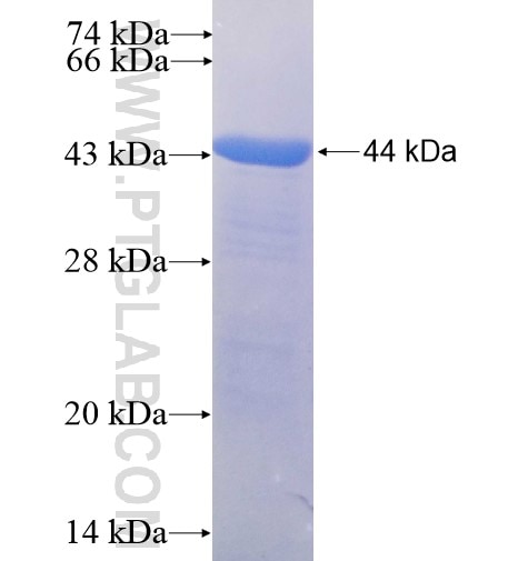 DGKH fusion protein Ag5445 SDS-PAGE