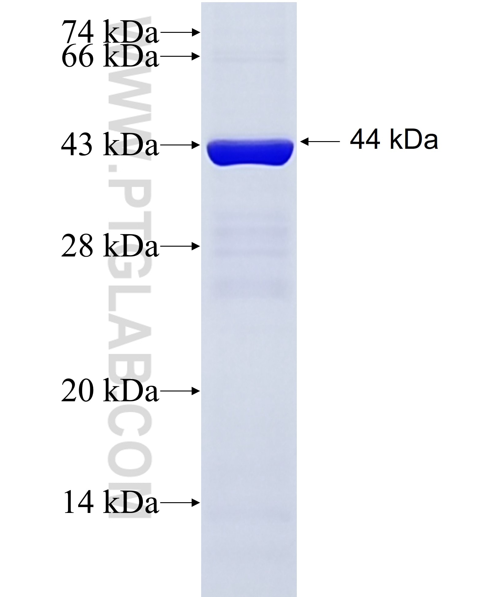 DGKH fusion protein Ag5445 SDS-PAGE