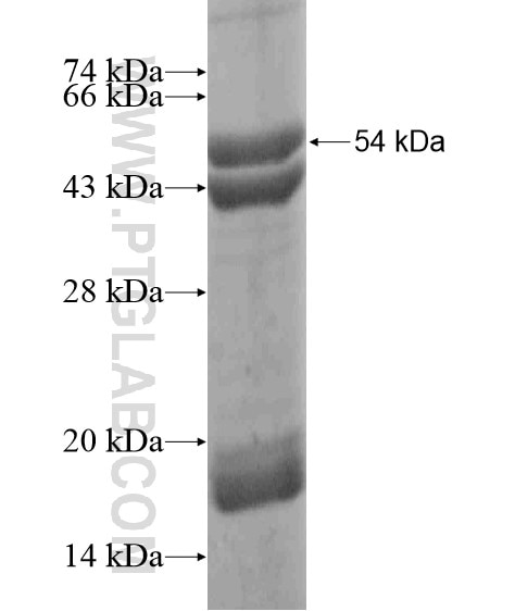 DGKK fusion protein Ag19639 SDS-PAGE