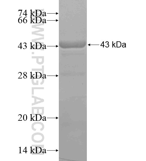 DGKK fusion protein Ag19651 SDS-PAGE