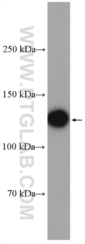 Western Blot (WB) analysis of HuH-7 cells using DGKK-Specific Polyclonal antibody (20090-1-AP)