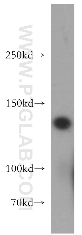 Western Blot (WB) analysis of human testis tissue using DGKK-Specific Polyclonal antibody (20090-1-AP)