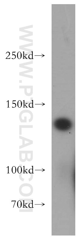 WB analysis of human testis using 20090-1-AP