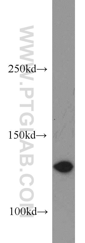 Western Blot (WB) analysis of human testis tissue using DGKK-Specific Polyclonal antibody (20090-1-AP)