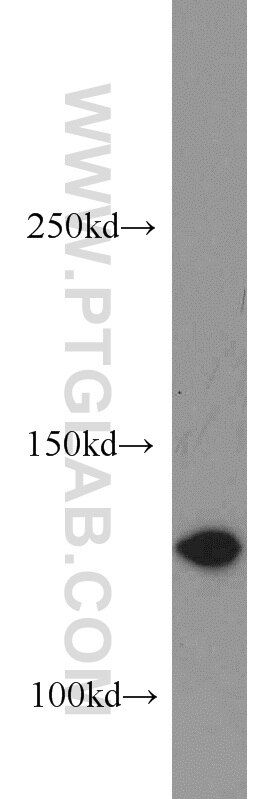 WB analysis of human testis using 20090-1-AP