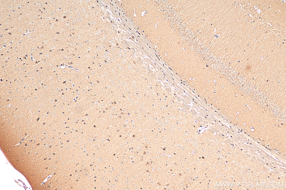 IHC staining of mouse brain using 17885-1-AP