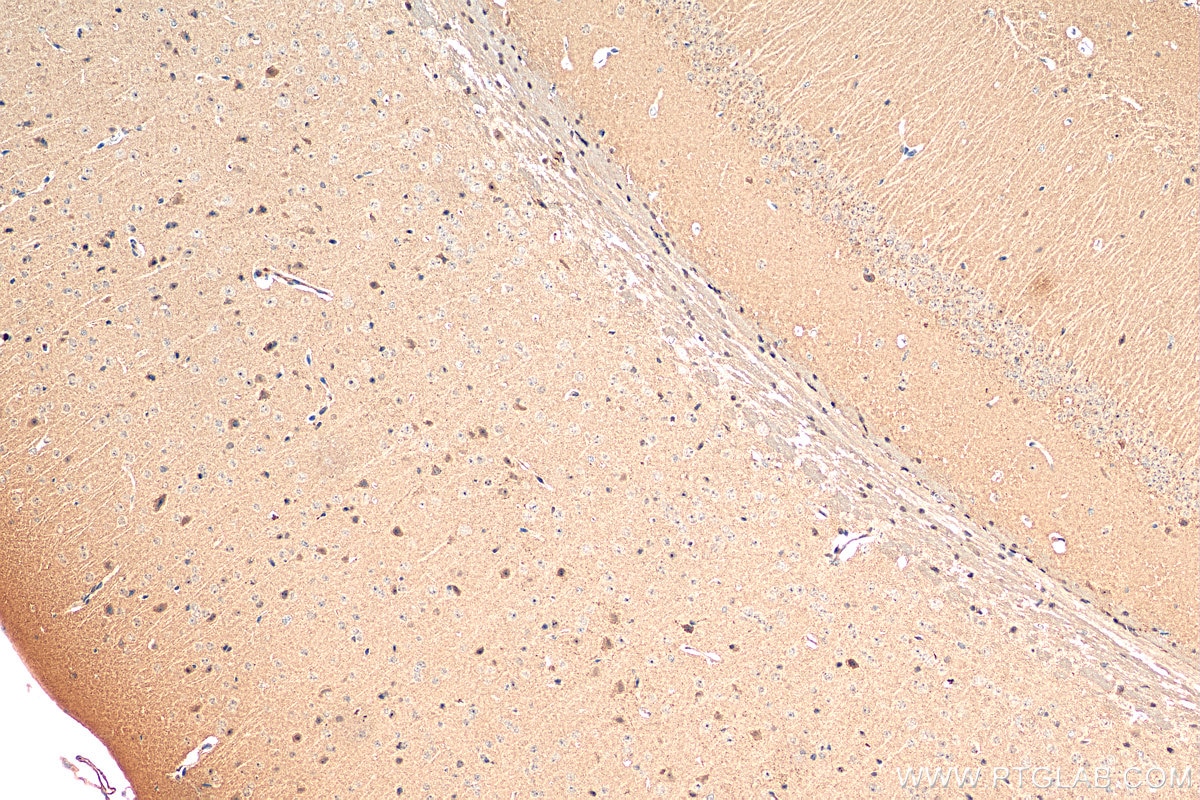 Immunohistochemistry (IHC) staining of mouse brain tissue using DGKQ Polyclonal antibody (17885-1-AP)