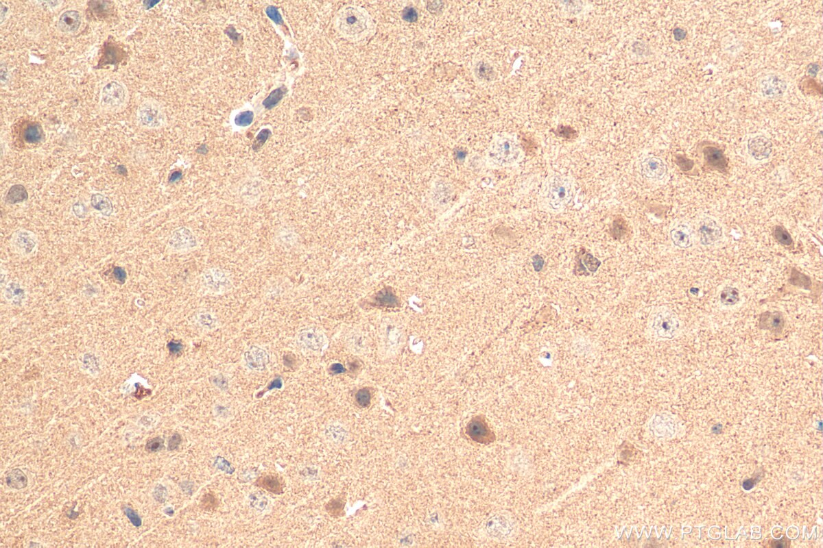 Immunohistochemistry (IHC) staining of mouse brain tissue using DGKQ Polyclonal antibody (17885-1-AP)